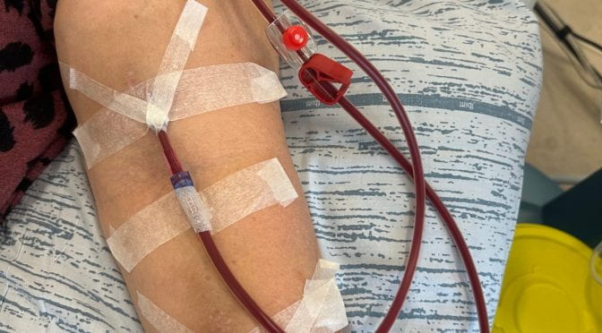 Jane Jøhnke har nyresvigt: ”Hvis jeg går i 14 dage uden dialyse, så dør jeg af hjertestop”
